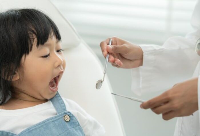 抜かない床矯正